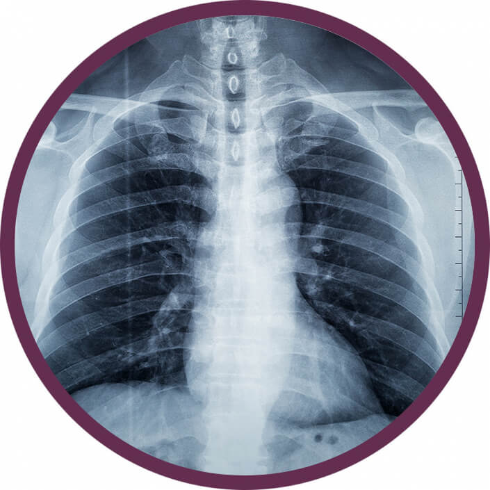 ct-diagnosztika-tudo-ct